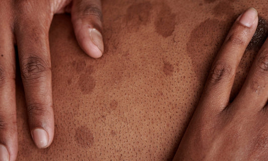 Natural Skincare Tips for Every Skin Type: What Works and What Doesn’t